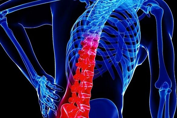 As razóns para o desenvolvemento da osteocondrose torácica