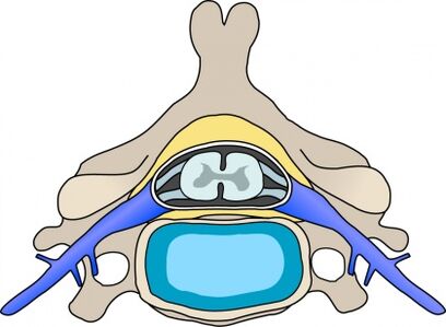 Protabio na vértebra con osteocondrose cervical